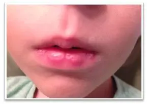 A close up of the lips and chin of a child